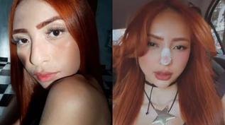 Ruivinha de Marte muda o rosto com procedimentos est�ticos: 'Bem bonitinho'