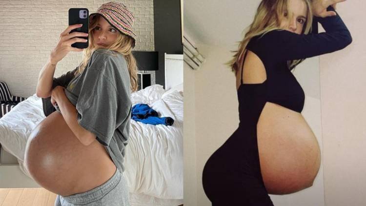 A influenciadora compartilhou as mudan�as que ocorreram em seu corpo ap�s a gesta��o de Mel e Bento