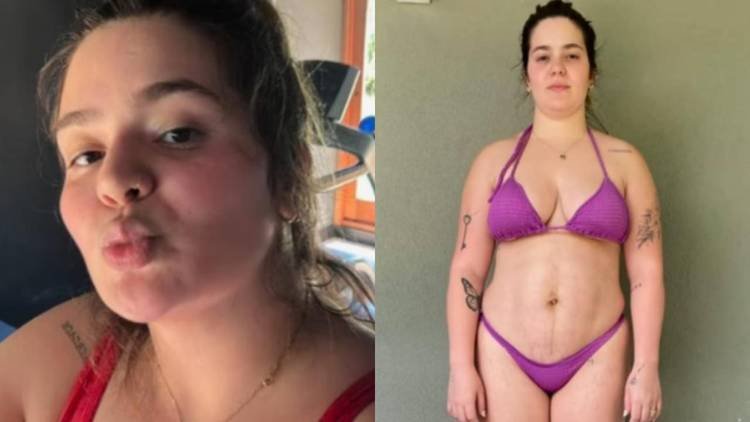 Influenciadora que recentemente passou por uma lipoaspira��o compartilhou novos registros de seu corpo