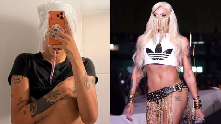Veja o antes e depois do nariz da drag queen mais famosa do mundo