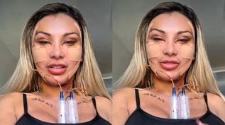 Andressa Urach gasta R$ 100 mil em cirurgia para voltar a ter 20 anos