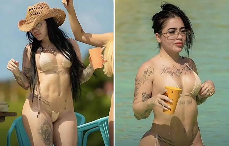 Cantora passou por correção de diástase, hérnia umbilical, lipo HD e lipoenxertia após a gestação