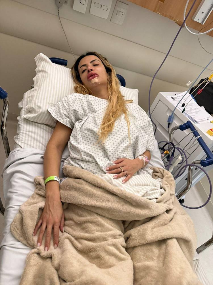 Influenciadora Janaina dos Prazeres ap�s ser agredida pelo ex