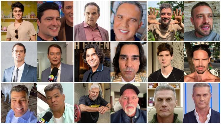 Gal�s da Globo antes e depois da harmoniza��o facial

