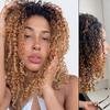 Influenciadora relata uso indevido de raio-x ap�s ficar entalada com bolas