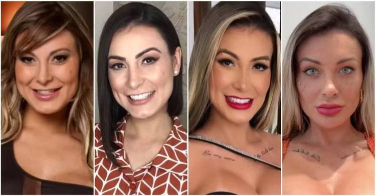 Andressa Urach revela seu antes e depois: todas as cirurgias e interven��es est�ticas