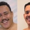 Ex-BBB mostra antes e depois do corpo ap�s emagrecer 31 kg em 6 meses