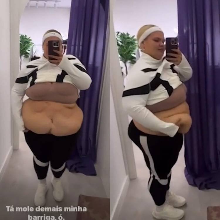 Thais Carla desabafa sobre excesso de pele ap�s fazer bari�trica