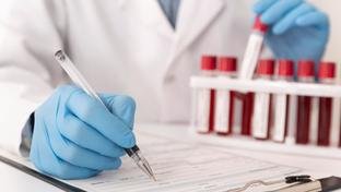 Teste gen�tico identifica c�nceres no sangue, c�rebro e gastrointestinal