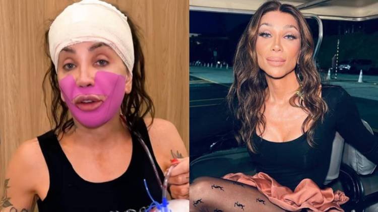 Influenciadora compartilhou o pr�-operat�rio nas redes sociais