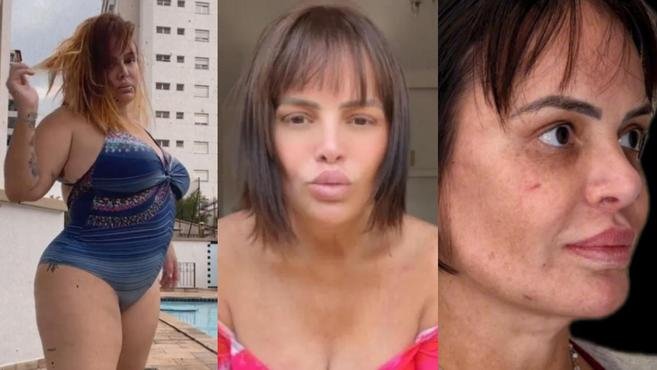 Valentina Francavilla perde 40 kg e faz procedimentos no rosto; veja v�deo