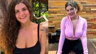 Influenciadora revela uso de Botox nos seios e gasto de R$ 40 mil