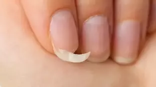 Adeus, unhas quebradiças: Receita caseira ajuda a fortalecer as unhas