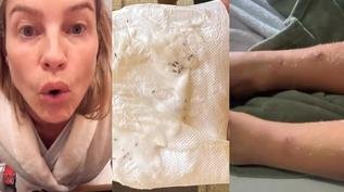 Luana Piovani mostra piolhos e ferimentos dos filhos e provoca Pedro Scooby
