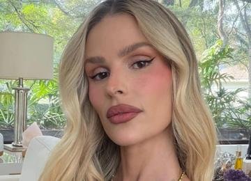 Yasmin Brunet mostra marcas do lipedema e relata: 'Dor e queimação'