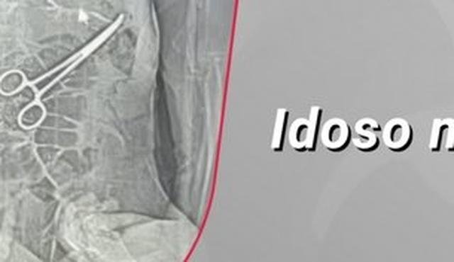 Pin�a � esquecida dentro de idoso durante cirurgia