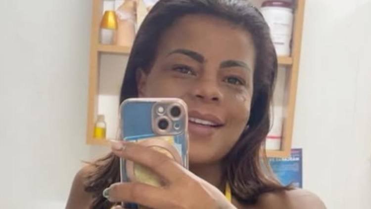 Funkeira compartilhou cliques inéditos do procedimento nas redes sociais