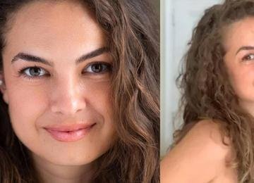 Saiba por que Lua Blanco escondeu o câncer e não contou ao público