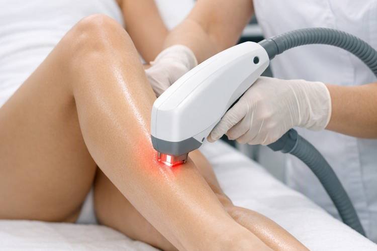 Depilação a laser