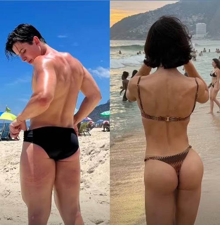 Bella Longuinho mostra o antes e depois do bumbum