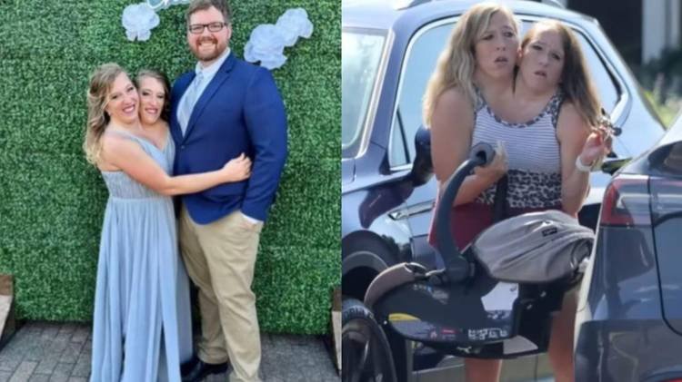 Abby e Brittany Hensel cresceram sob os holofotes por condi��o gen�tica rara