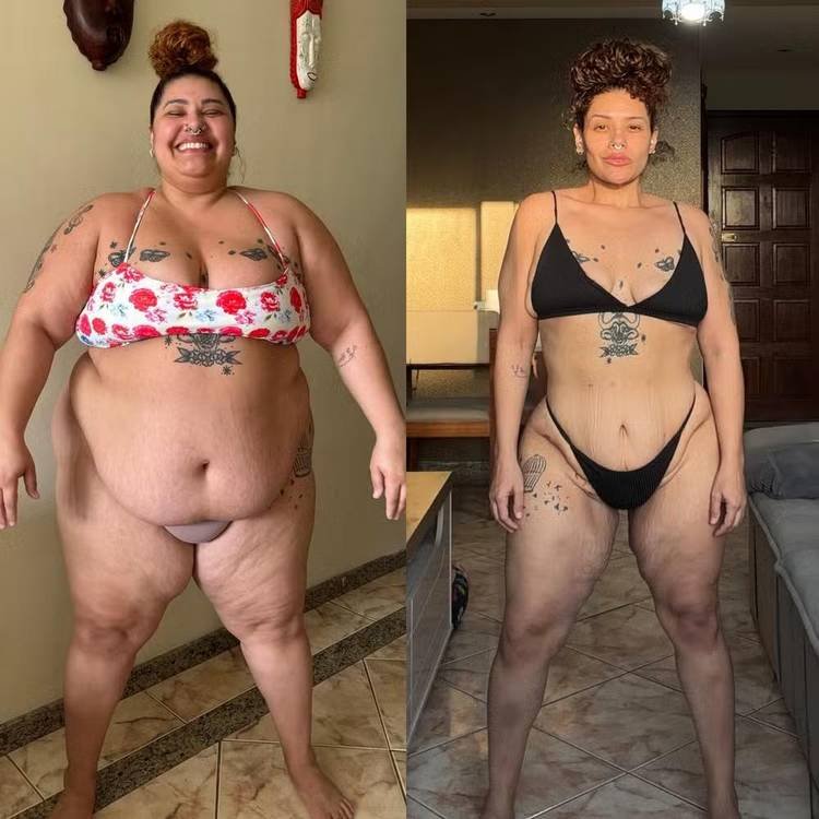 Aila Menezes bariátrica