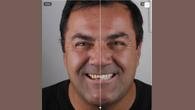 Ferramenta digital permite visualizar previamente o resultado de tratamentos estéticos odontológicos e aprimora fotos feitas pelo celular para uso profissional nas redes sociais