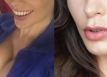 Atriz revela decisão íntima e surpreende ao anunciar cirurgia estética
