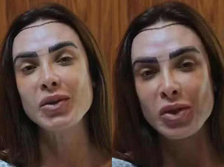 Nicole Bahls revela procedimento capilar após desconforto com penteados