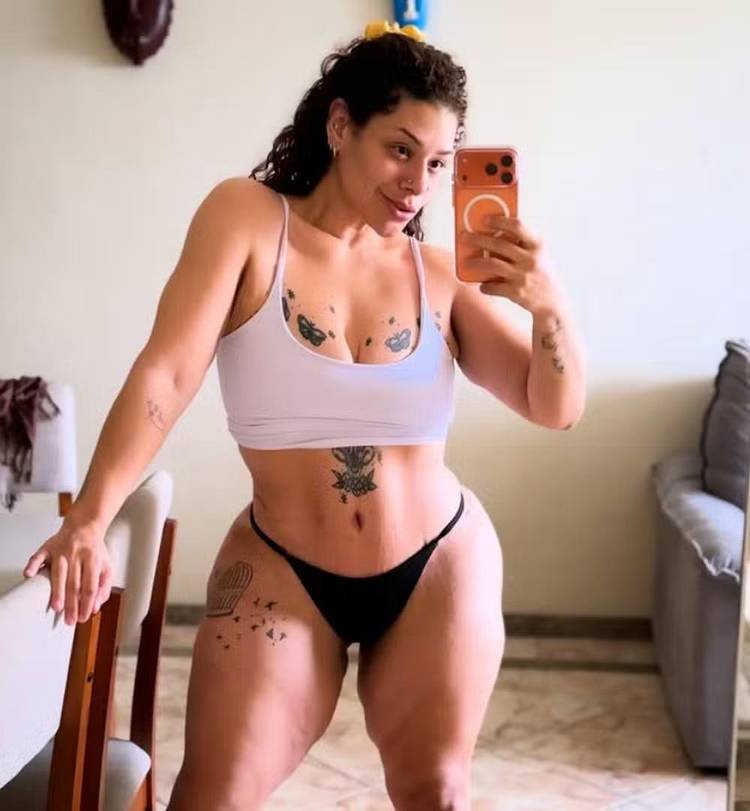 Aila Menezes abdominoplastia