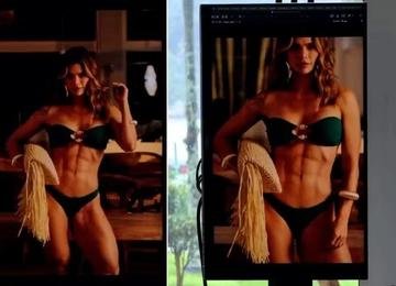 'Costura abdominal': a cirurgia para barriga definida de Kelly Key
