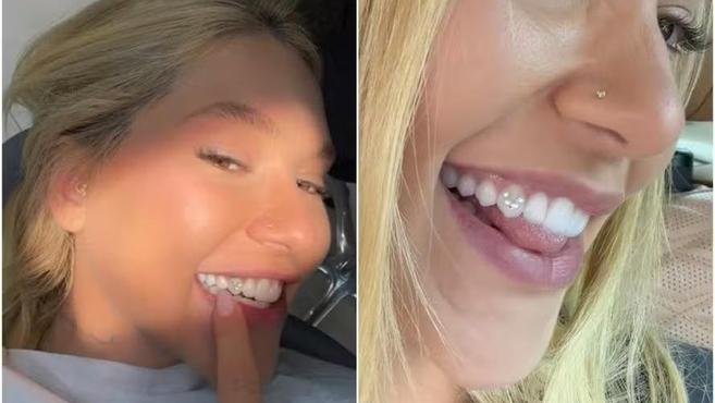 Virginia: o que significa o piercing de diamantes no dente da influencer?