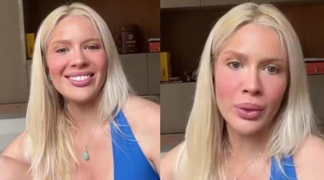 Karoline Lima se pronuncia sobre gravidez após fãs notarem 'barriguinha' 