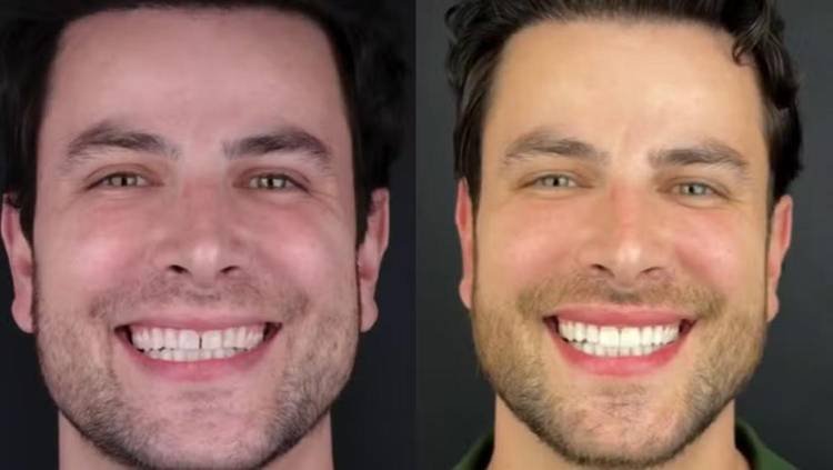 Ex-BBB Gustavo Marsengo 