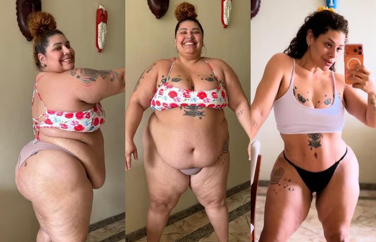 Ex-'The Voice' choca com antes e depois após perder 90 kg e abdominoplastia
