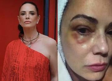 Luiza Brunet reage à condenação de agressor após violência doméstica