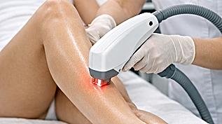 Depilação a laser: saiba quais fatores influenciam o preço do tratamento 