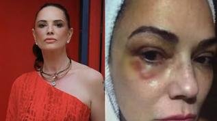 Luiza Brunet reage à condenação de agressor após violência doméstica