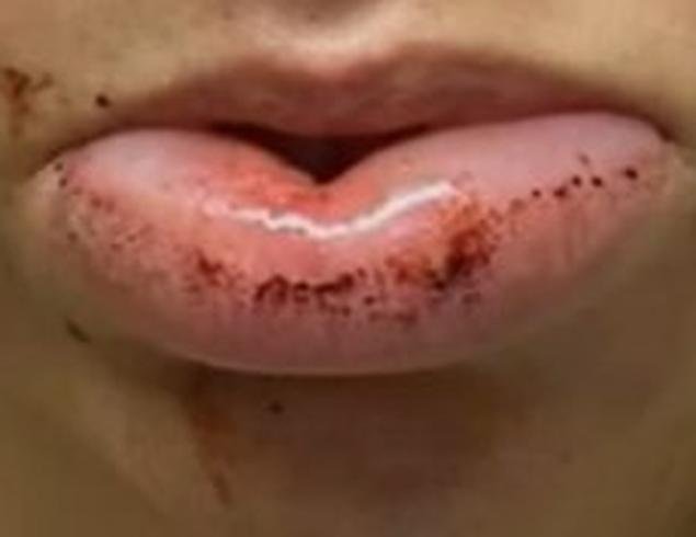 Mulher teme que marido agressor saia da cadeia ap�s audi�ncia