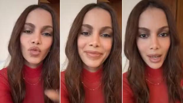 Anitta surge com novo visual e fala sobre procedimentos est�ticos na web