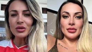 Andressa Urach dá entrada em hospital e desabafa sobre diagnóstico: “Um dia a conta chega”
