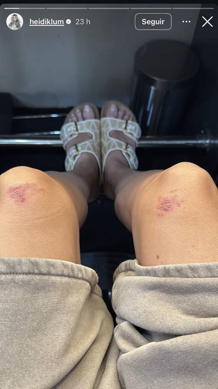 ferimentos nos joelhos