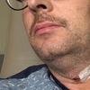 Ator famoso descobre câncer causado por vírus transmitido no sexo e alerta