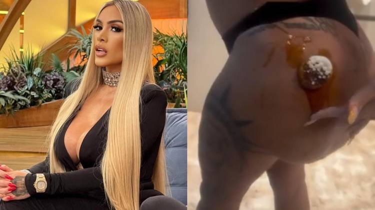 Juju Ferrari compartilhou imagens do problema de sa�de nas redes sociais