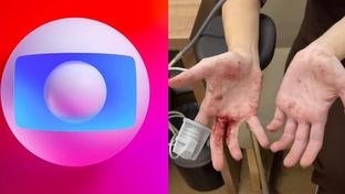“Muito sangue, machucada e cheia de cortes”: Atriz da Globo sofre assalto e vídeo expõe sofrimento