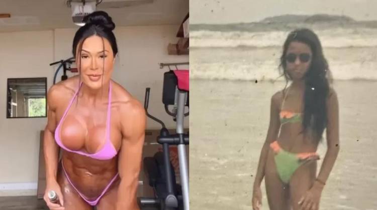 Antes e depois de Gracyanne Barbosa 