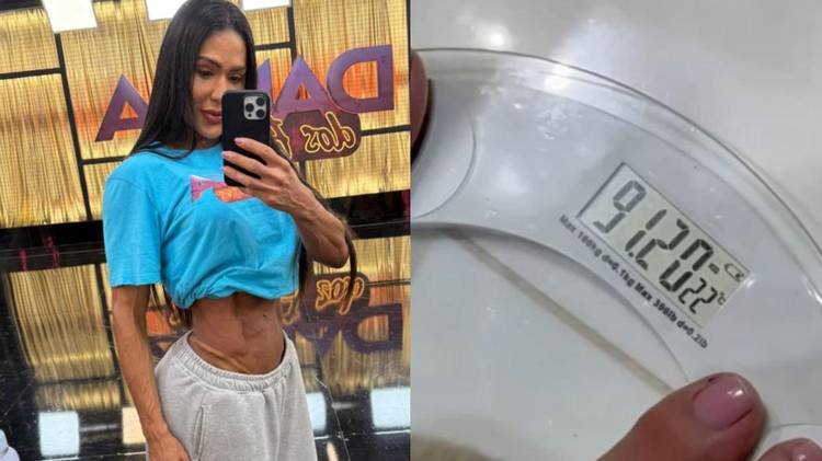 Musa fitness relatou ganho de peso ap�s sofrer acidente no �ltimo final de semana
