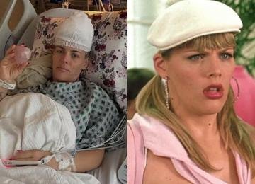 O que é oligodendroglioma? Câncer raro que afetou atriz de 'As Branquelas'