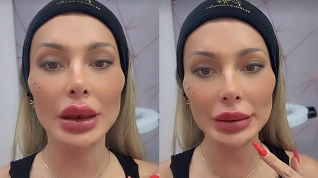 Andressa Urach relata perrengue ao fazer procedimento na boca
