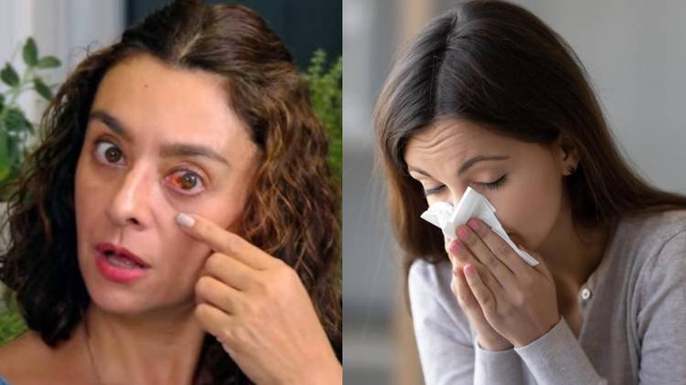 Apresentadora explicou o motivo de aparecer com os olhos vermelhos em programa